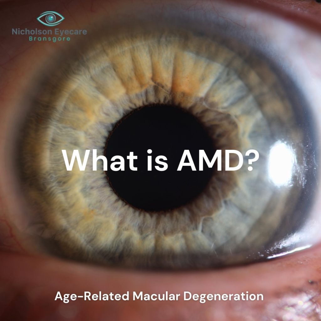 AMD, LOW VISION, OPTICIAN CHRISTCHURCH